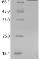 Human Zinc finger Y-chromosomal protein (ZFY), partial Recombinant Protein, C-His, aa 1–409, E.coli - BioCrest Sci