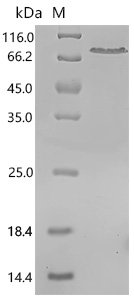 Human Zinc finger Y-chromosomal protein (ZFY), partial Recombinant Protein, C-His, aa 1–409, E.coli, Homo sapiens (Human), E.coli, C-terminal 6xHis-tagged, 51.4 kDa, purity >≥ 90% as determined by SDS-PAGE.
