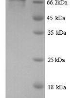 Human Peroxisomal multifunctional enzyme type 2 (HSD17B4) Recombinant Protein, N-His, aa 1–736, Yeast - BioCrest Sci