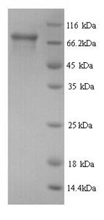 Human Peroxisomal multifunctional enzyme type 2 (HSD17B4) Recombinant Protein, N-His, aa 1–736, Yeast, Homo sapiens (Human), Yeast, N-terminal 6xHis-tagged, 81.7 kDa, purity >≥ 90% as determined by SDS-PAGE.
