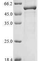 Macaca fascicularis Ribitol-5-phosphate transferase FKTNn (FKTN), partial Recombinant Protein - BioCrest Sci