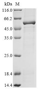 Macaca fascicularis Ribitol-5-phosphate transferase FKTNn (FKTN), partial Recombinant Protein, Macaca fascicularis (Crab-eating macaque) (Cynomolgus monkey), E.coli, N-terminal 10xHis-tagged and C-terminal Myc-tagged, 58.0 kDa, purity >≥ 85% as determined by SDS-PAGE.