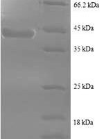 Human Sperm surface protein Sp17 (SPA17), partial Recombinant Protein - BioCrest Sci