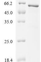 Mouse Matrix metalloproteinase-17 (Mmp17) Recombinant Protein - BioCrest Sci