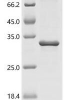 Human Putative endogenous retrovirus group K member 11-1 Env polyprotein (ERVK11-1) Recombinant Protein - BioCrest Sci