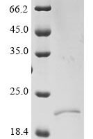 Severe acute respiratory syndrome coronavirus 2 Envelope small membrane protein & Membrane protein (E & M), partial Recombinant Protein - BioCrest Sci