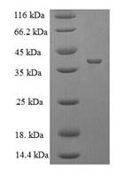 Escherichia coli Protease 7 (ompT) Recombinant Protein - BioCrest Sci