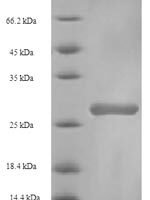 Bovine Beta-1,4-galactosyltransferase 1 (B4GALT1), partial Recombinant Protein, N-GST, aa 1–24, E.coli - BioCrest Sci