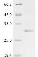 Saponaria officinalis Ribosome-inactivating protein saporin-9 (SAP9)(D7N,L8A) Recombinant Protein - BioCrest Sci