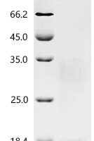 Macaca fascicularis Thymic stromal lymphopoietin (TSLP) Recombinant Protein - BioCrest Sci