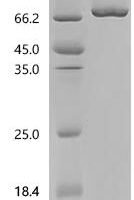 Human Seizure protein 6 homolog (SEZ6), partial Recombinant Protein, N-HSA/C-10His, aa 768–832 - BioCrest Sci