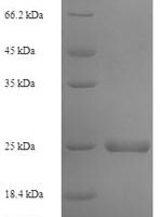 Human Stromal cell-derived factor 2 (SDF2) Recombinant Protein - BioCrest Sci