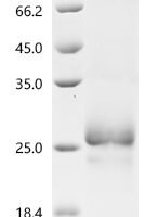Necator americanus Ancylostoma secreted protein 2 (ASP2) Recombinant Protein - BioCrest Sci