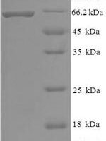 Human Histone deacetylase 8 (HDAC8) Recombinant Protein - BioCrest Sci