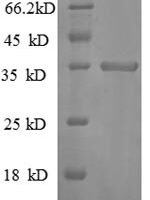 Mouse C-X-C motif chemokine 10 (Cxcl10) Recombinant Protein - BioCrest Sci