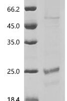 Human Claudin-4 (CLDN4)-Detergent Recombinant Protein - BioCrest Sci