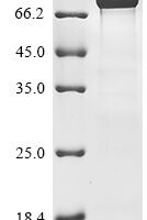 Human E3 ubiquitin-protein ligase RNF168 (RNF168) Recombinant Protein, C-10His - BioCrest Sci