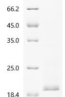 Human Cytochrome c oxidase subunit 1 (MT-CO1), partial Recombinant Protein, N-His-SUMOstar - BioCrest Sci
