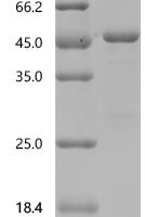 Mouse Hemoglobin subunit beta-2 (Hbb-b2) Recombinant Protein, C-GST - BioCrest Sci