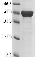 Human adenovirus C serotype 5 Fiber protein (L5), partial Recombinant Protein - BioCrest Sci