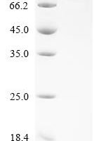 Human Butyrophilin-like protein 2 (BTNL2), partial Recombinant Protein, C-hFc1-Avi - BioCrest Sci