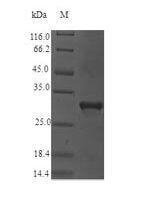 Plantago lanceolata Major pollen allergen Pla l 1 Recombinant Protein - BioCrest Sci