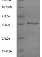 Human 60S acidic ribosomal protein P0 (RPLP0) Recombinant Protein - BioCrest Sci