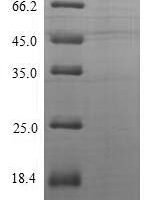 Human C-X-C motif chemokine 10 (CXCL10) Recombinant Protein, N-His-Myc - BioCrest Sci