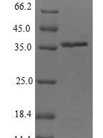 Citrobacter freundii Dihydroxyacetone kinase (dhaK), partial Recombinant Protein - BioCrest Sci