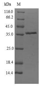 Citrobacter freundii Dihydroxyacetone kinase (dhaK), partial Recombinant Protein, Citrobacter freundii, E.coli, N-terminal 6xHis-SUMO-tagged, 35.9 kDa, purity >≥ 90% as determined by SDS-PAGE.