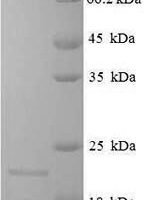 Arachis hypogaea Conglutin-7 Recombinant Protein - BioCrest Sci