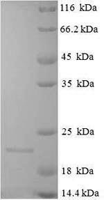 Arachis hypogaea Conglutin-7 Recombinant Protein, Arachis hypogaea (Peanut), E.coli, N-terminal 6xHis-tagged, 22.0 kDa, purity >≥ 90% as determined by SDS-PAGE.