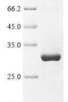 Rat Transient receptor potential cation channel subfamily A member 1 (Trpa1), partial Recombinant Protein - BioCrest Sci