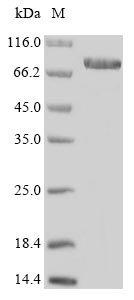 Human Ecto-NOX disulfide-thiol exchanger 1 (ENOX1) Recombinant Protein, N-10His/C-Myc, Homo sapiens (Human), E.coli, N-terminal 10xHis-tagged and C-terminal Myc-tagged, 80.3 kDa, purity >≥ 85% as determined by SDS-PAGE.