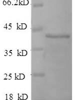 Human Fibroblast growth factor receptor 3 (FGFR3 IIIc), partial Recombinant Protein, N-His, aa 23–375, E.coli - BioCrest Sci