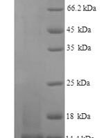 Mouse Nogo-B receptor (Nus1), partial Recombinant Protein, N-His - BioCrest Sci