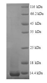 Mouse Nogo-B receptor (Nus1), partial Recombinant Protein, N-His, Mus musculus (Mouse), Yeast, N-terminal 6xHis-tagged, 13.0 kDa, purity >≥ 90% as determined by SDS-PAGE.