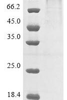 Human P-selectin (SELP) (V640L), partial Recombinant Protein - BioCrest Sci