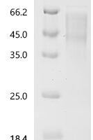 MouseV-set domain containing T-cell activation inhibitor 1 (Vtcn1) Recombinant Protein - BioCrest Sci