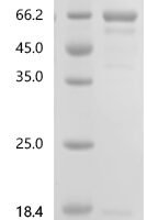 Parabacteroides distasonis Chaperonin GroEL (groEL) Recombinant Protein, C-His - BioCrest Sci