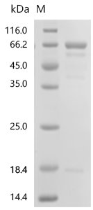 Parabacteroides distasonis Chaperonin GroEL (groEL) Recombinant Protein, C-His, Parabacteroides distasonis (strain ATCC 8503 / DSM 20701 / CIP 104284 / JCM 5825 / NCTC 11152), E.coli, C-terminal 6xHis-tagged, 65.3 kDa, purity >≥ 85% as determined by SDS-PAGE.