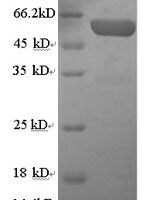 Human Serum paraoxonase/arylesterase 1 (PON1) Recombinant Protein, N-GST - BioCrest Sci