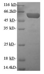 Human Serum paraoxonase/arylesterase 1 (PON1) Recombinant Protein, N-GST, Homo sapiens (Human), E.coli, N-terminal GST-tagged, 66.6 kDa, purity >≥ 90% as determined by SDS-PAGE.