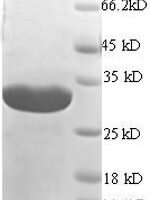 Mouse H-2 class II histocompatibility antigen gamma chain (Cd74), partial Recombinant Protein - BioCrest Sci