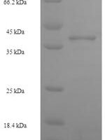Human Zinc finger protein 581 (ZNF581) Recombinant Protein - BioCrest Sci