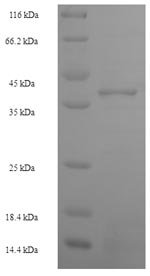 Human Zinc finger protein 581 (ZNF581) Recombinant Protein, Homo sapiens (Human), E.coli, N-terminal 6xHis-SUMO-tagged, 38.0 kDa, purity >≥ 90% as determined by SDS-PAGE.