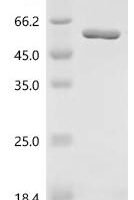 Staphylococcus aureus Enolase (eno) Recombinant Protein, C-His - BioCrest Sci