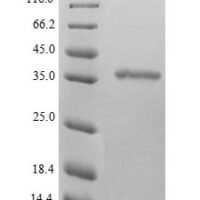 Human D-beta-hydroxybutyrate dehydrogenase, mitochondrial (BDH1) Recombinant Protein, N-His - BioCrest Sci