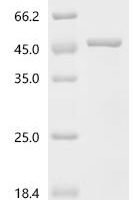 Rat Dihydroorotate dehydrogenase (quinone), mitochondrial (Dhodh), partial Recombinant Protein - BioCrest Sci