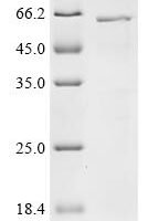 Orientia tsutsugamushi 56 kDa type-specific antigen Recombinant Protein - BioCrest Sci